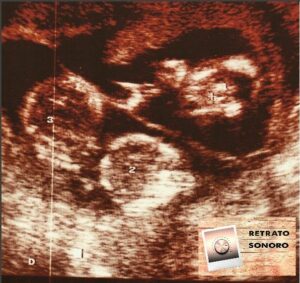 Esteban y los trillizos que le regaló Ángeles.